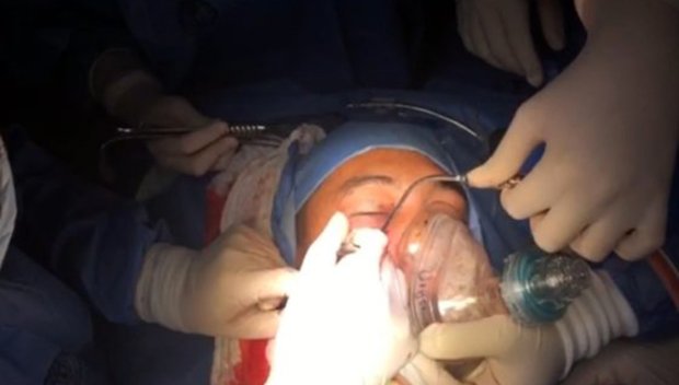 Pic shows: One moment of the surgery. Colombian Military doctors carried out a risky operation to remove a grenade, which could have exploded at any moment, from the face of a soldier. The dangerous medical procedure took place outside the Military Hospital in the capital city Bogota. In fact it was carried out in the car park of the facility where a temporary operating theatre was set up, to keep the rest of the hospital out of harmÃƒÂ­s way. The chief of surgery, William Sanchez said: "It was a decisive moment, logically one of stress and uncertainty, but there was no other option but to push on to save the life of the patient, even praying and asking God not to let a bigger tragedy happen." The surgeon described how the team carried out the operation with the upmost care, not only to save the life of the patient, but to preserve their own, seeing as the explosive could have gone off at any time. He said: "We now have an established protocol. We logically did it outside the hospital, because if it were to activate it needs to be somewhere it will have the least impact." The solider, Luis Eduardo Perez Arango, works for the eighth division of the Arauca Army, he is now out of danger and remains in recovery under strict medical observation. How the grenade became lodged in his face is still under investigation, however some reports signal that the misuse of a heavy fire weapon resulted in the explosive accidentally hitting the officer and becoming wedged. (ends)